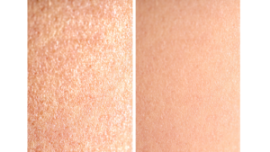 Ciri-ciri kulit dehidrasi vs kulit berminyak