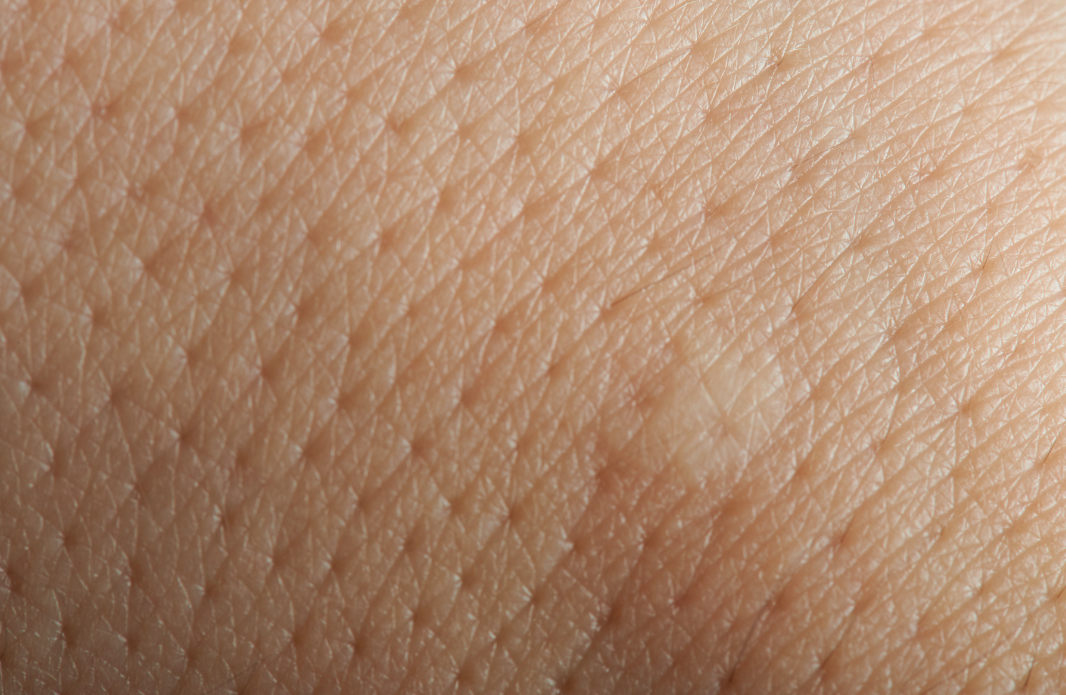 penyebab ingrown hair