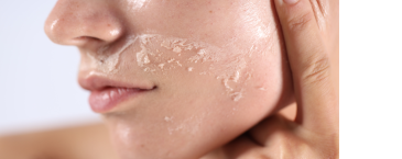 Kulit Wajah Terasa Kering Setelah Cuci Muka? Bisa Jadi Tanda Kulit Dehidrasi