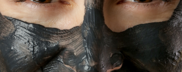 Komedo di Hidung Sulit Hilang? Ini yang Sering Menjadi Penyebabnya