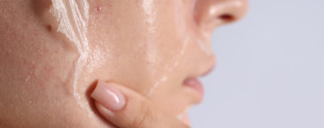 Kulit Mengelupas Setelah Pakai Skincare? Jangan Langsung Panik